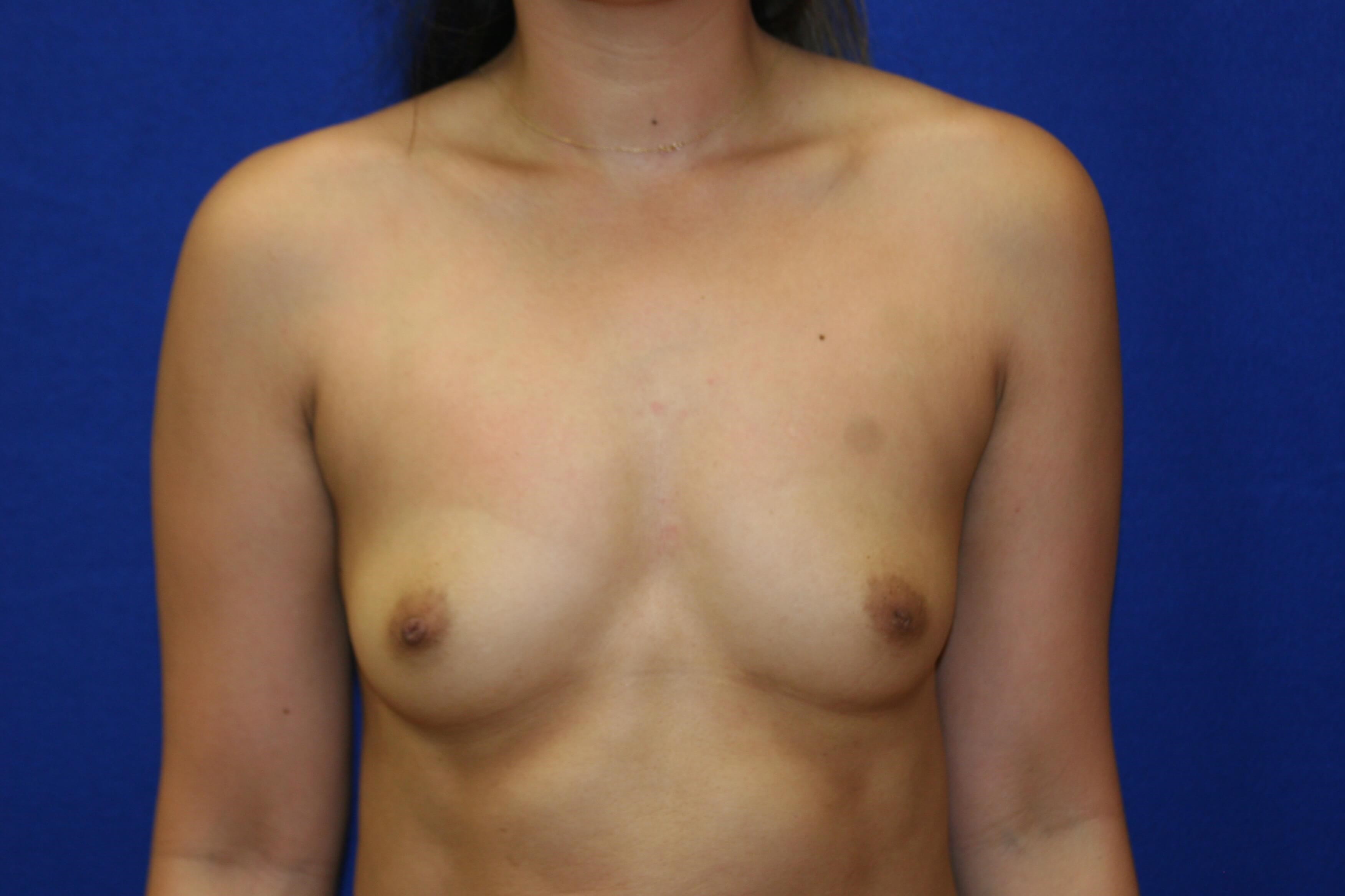 Before Image