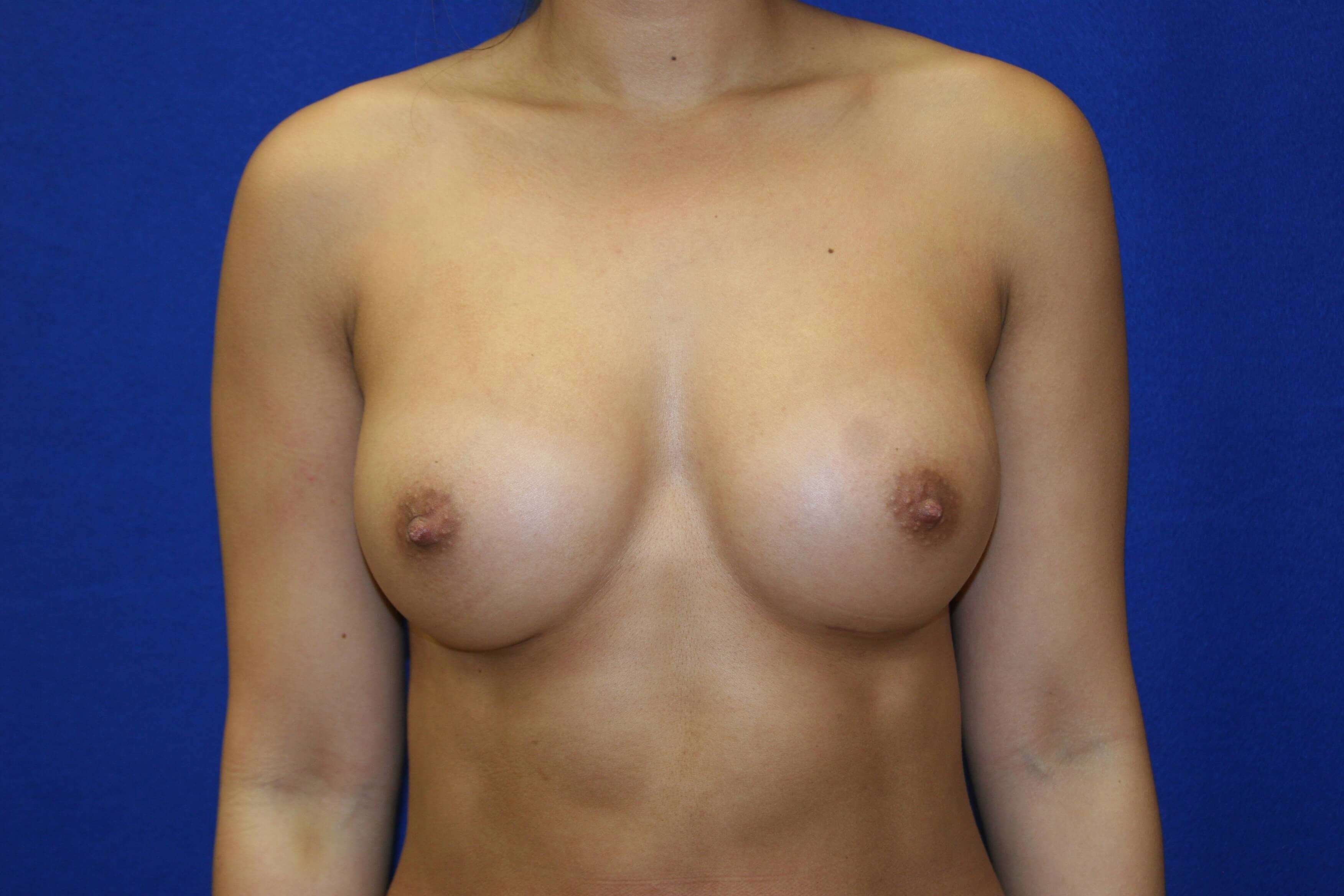 After Image