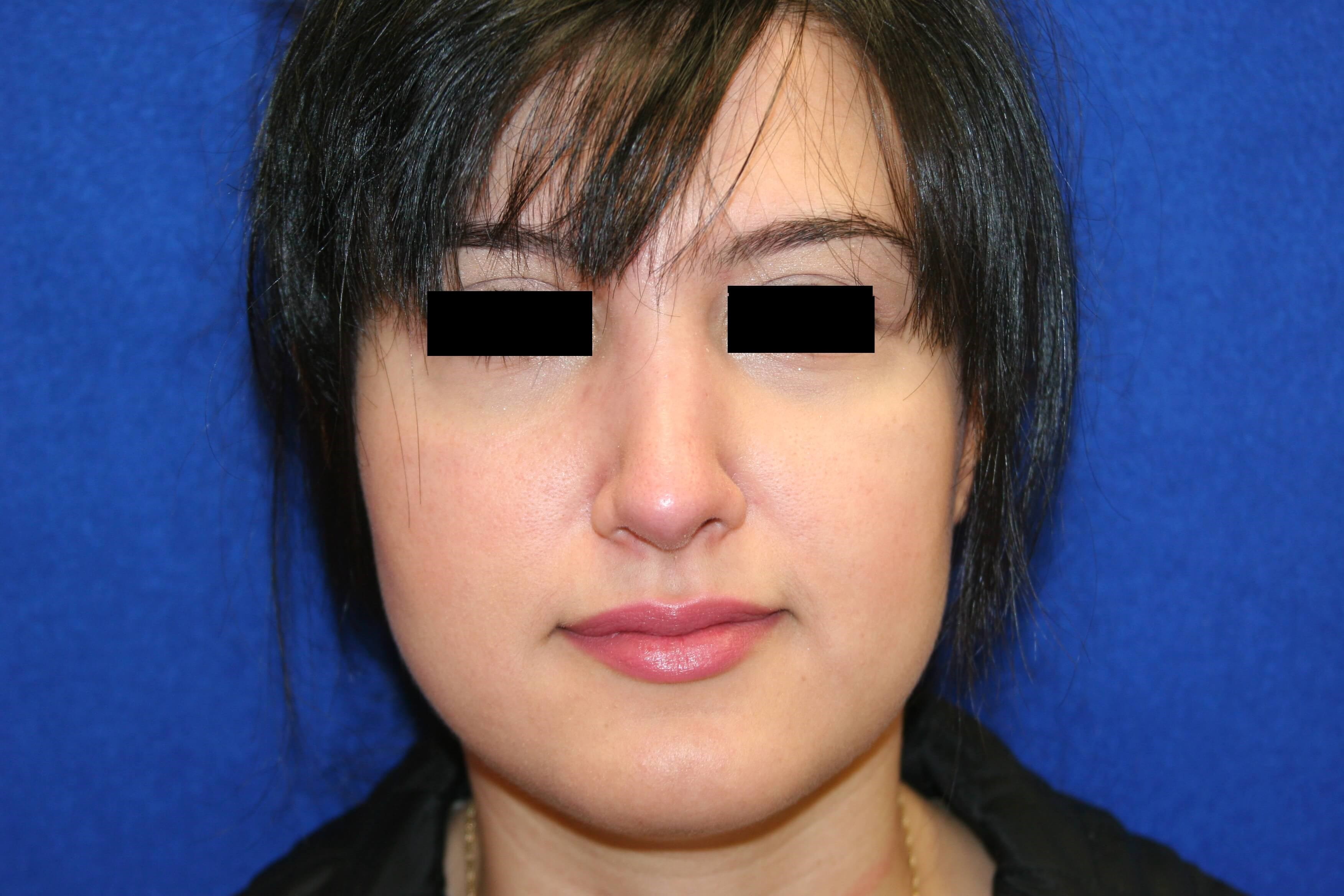 After Image