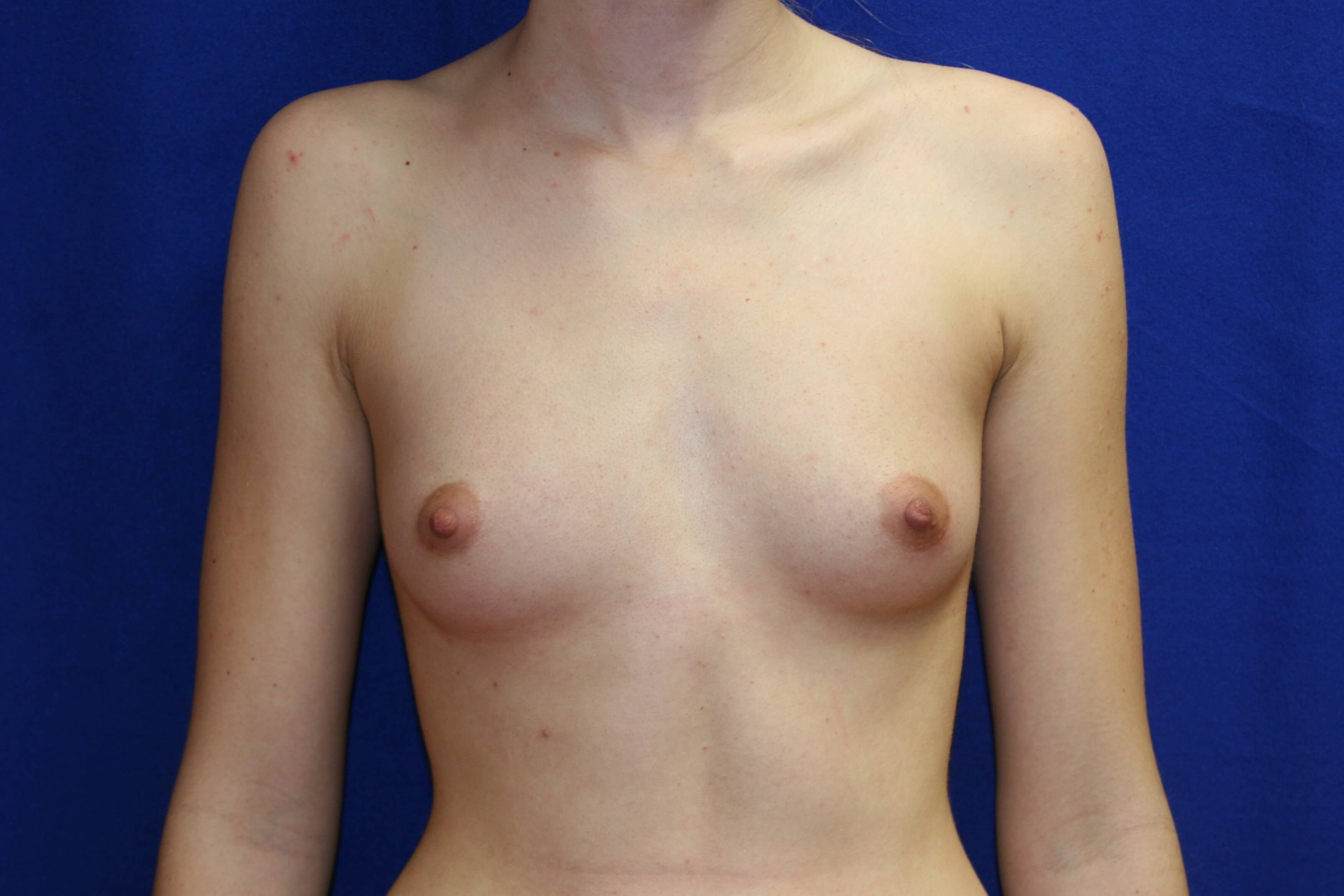 Before Image
